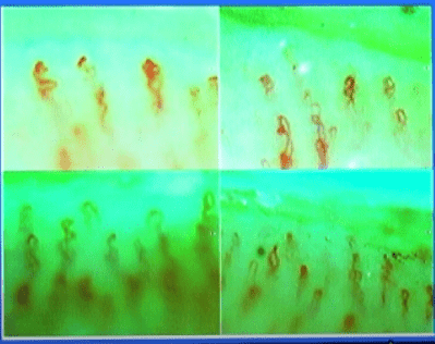 당뇨졸업-위한-필수-3가지-검사-알아보기(사진-당뇨스쿨)