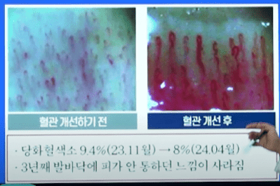 당뇨졸업-위한-필수-3가지-검사-알아보기(사진-당뇨스쿨)