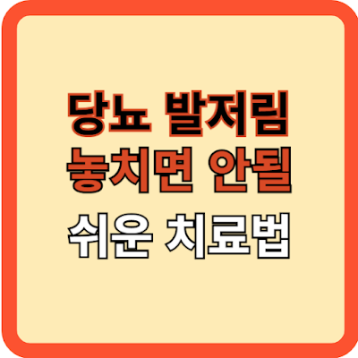 당뇨 발절임, 놓치면 안 될 쉬운 치료법