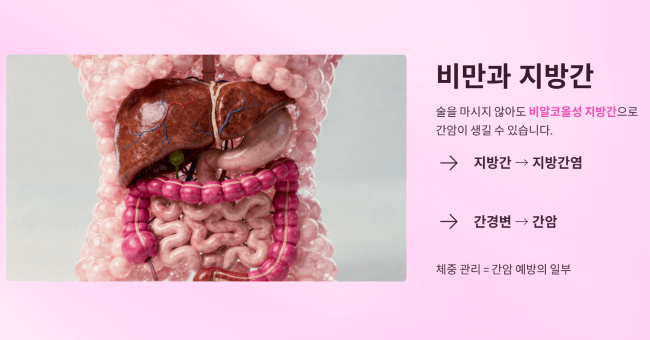 비만과 지방간