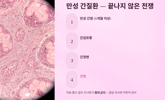 만성 간질환