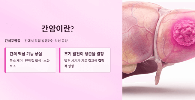 간암이란