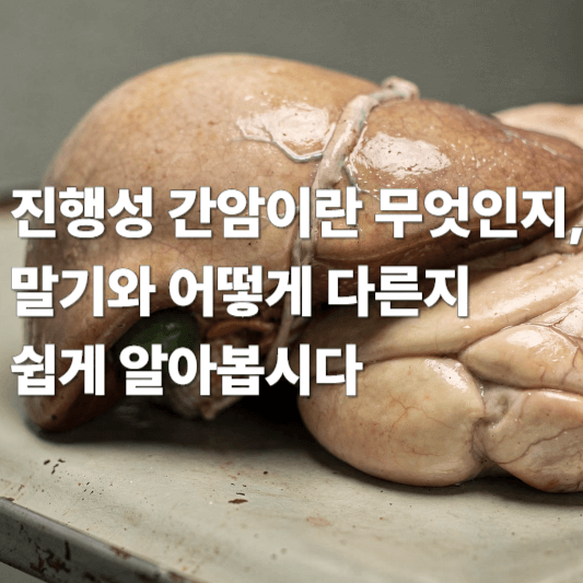 진행성 간암이란 무엇인지, 말기와 어떻게 다른지 쉽게 알아봅시다