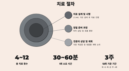 중입자 치료 방법