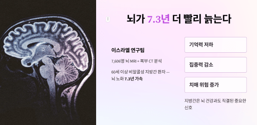 지방간과 뇌 위축