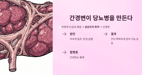 간성당뇨