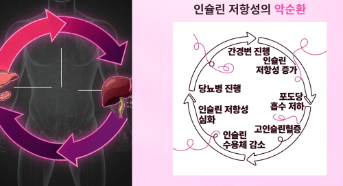 인슐린 저항성의 악순환