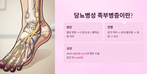 당뇨병성 족부병증이란