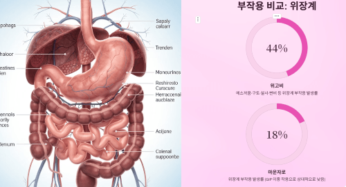 위장계 부작용 발생률