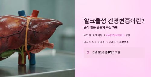 알코올성 간경변증이란