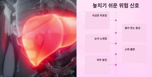 간경변증 위험 신호