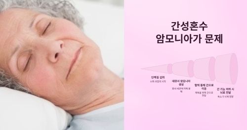 간성혼수 식사요법