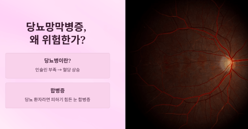 당뇨망막병증 조기 발견의 중요성