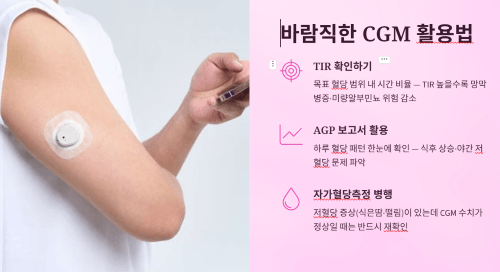 바람직한 CGM 활용법