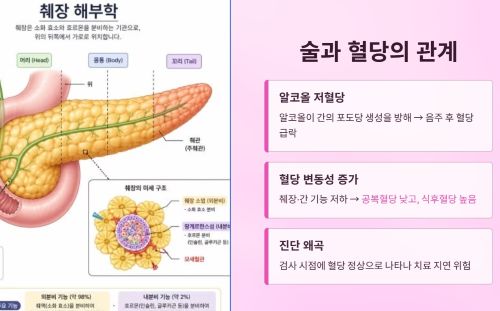 술과 혈당의 관계
