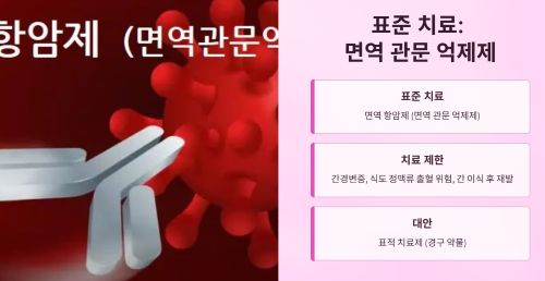 진행성 간암의 표준 치료