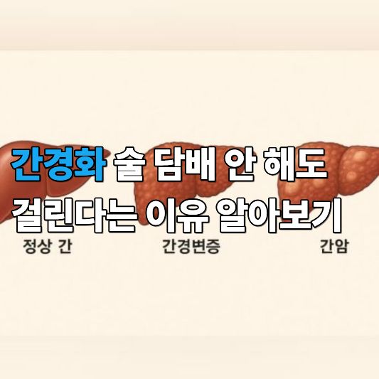 간경화