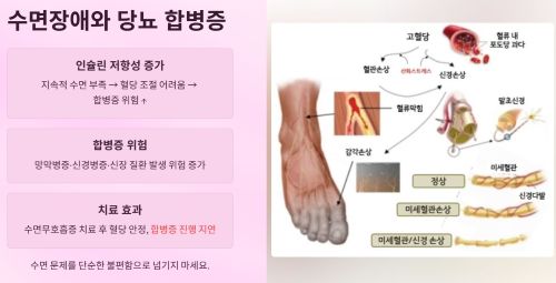 수면장애와 당뇨 합병증